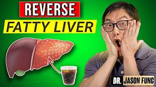 Dr. Jason Fung: The #1 Cause of Fatty Liver (It’s NOT What You Think)