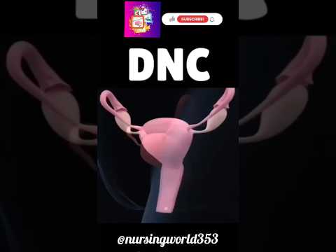 Dlc Full Form In Gynae