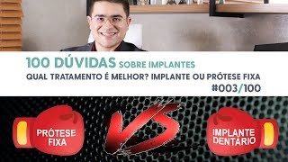 Prótese Fixa ou Implante Dentário?