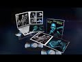 John Coltrane "Blue Train" Tone Poet Vinyl Editions (Trailer)
