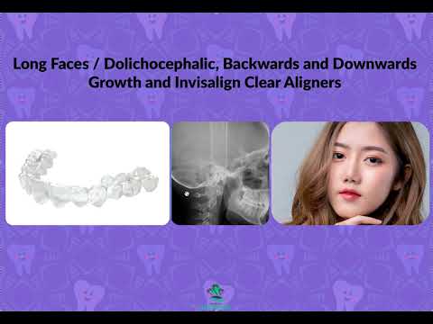 Video: Wat is 'n dolichofacial patroon?