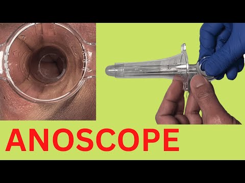 Video: Anoskopie