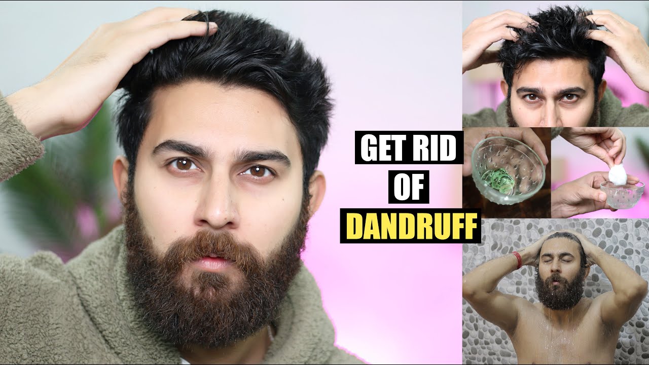 Get Rid Of Dandruff At Home How To Treat Dandruff Home Remedies get-rid-of-dandruff-at-home-how-to-treat-dandruff-home-remedies