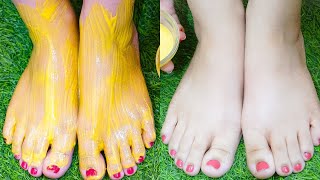 पैरों पर सालों साल जमीं मैल और गंदगी मिनटों में साफ करें पार्लर जैसा Whitening Pedicure घर पर करें