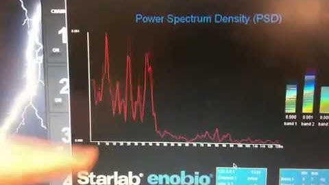 EEG-driven Music Generation