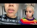 I GOT A $300 CHEMICAL PEEL AND THIS HAPPENED | Vanessa Lynn