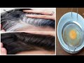 40+ White Hair Turn Black Hair Naturally Permanently in 3 minutes | White hair dye with herb &amp; egg