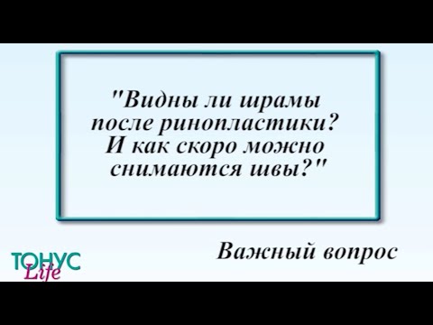 Видны ли шрамы после ринопластики? И как скоро снимаются швы?