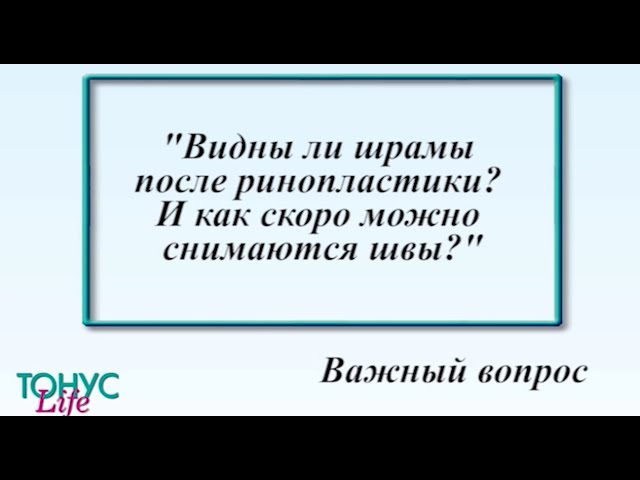 Видны ли шрамы после ринопластики? И как скоро снимаются швы?