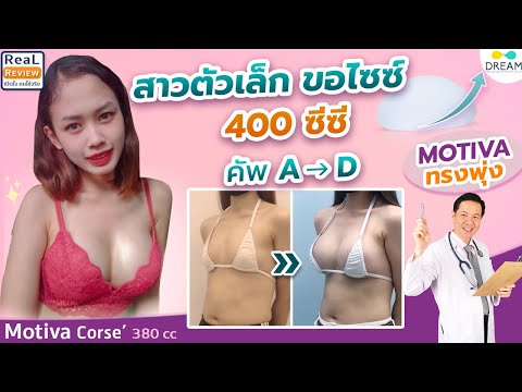 [Dream]ตัวเล็ก เสริมใหญ่ 400cc ให้สวยปลอดภัย ไม่ล้นตัว | รีวิวเสริมหน้าอก  Motiva Corse'