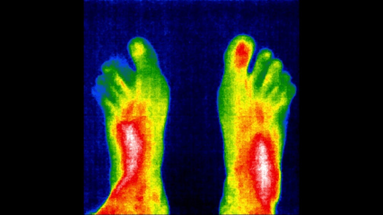 La Ciencia | El termómetro interno que nos mantiene con vida