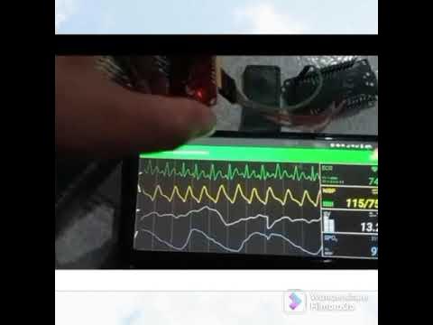 Tutorial ECG monitor esp8266 via Android - YouTube