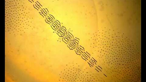 Magnetic particle snake