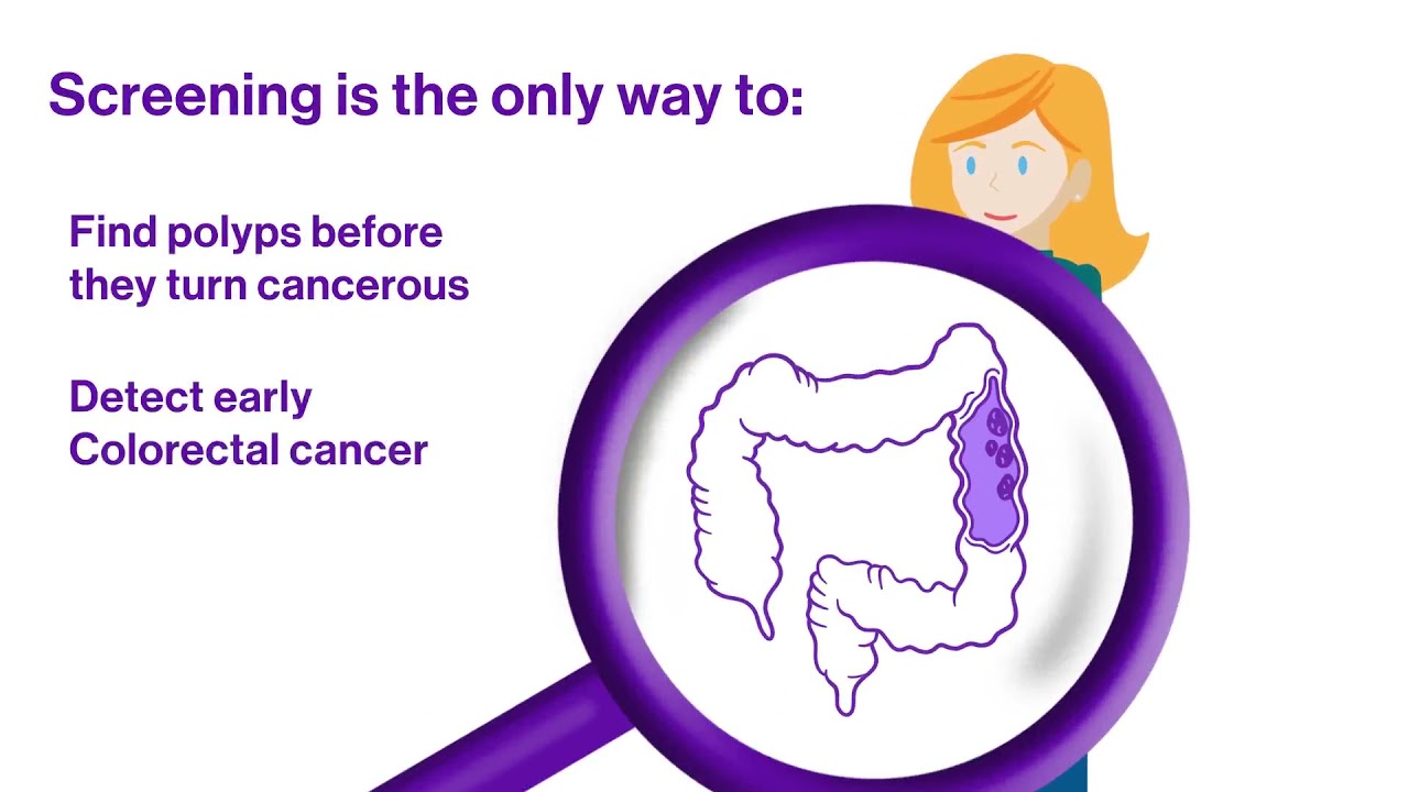 Colorectal Cancer What You Need To Know YouTube