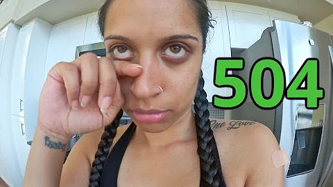 The Time I Got Stabbed Four Times (Day 504)