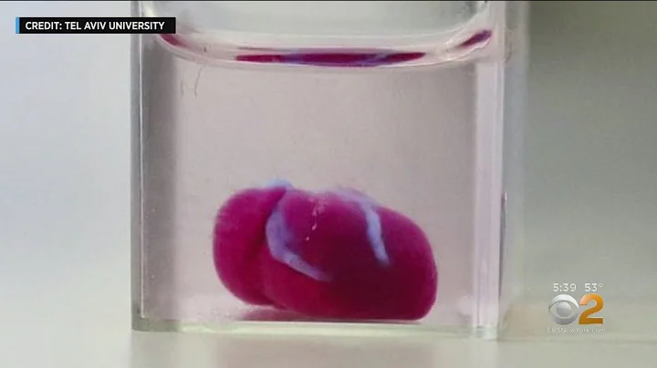 Lab Creates 3D-Printed Heart, Sign Of Future For Organ Transplants - DayDayNews