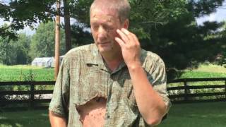 How Not To Destroy A Hornets Nest! Man Gets Stung Multiple Times! Burnt & Stung!