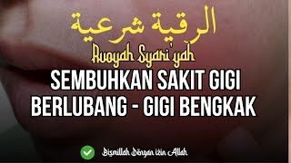 Download Mp3 RUQYAH SAKIT GIGI PALING AMPUH - GIGI BERLUBANG - GIGI BENGKAK Gudang lagu Download Mp3 RUQYAH SAKIT GIGI PALING AMPUH - GIGI BERLUBANG - GIGI BENGKAK