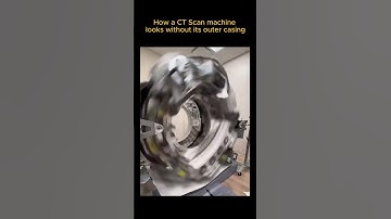 The Incredible Engineering Behind CT Scanner Technology!