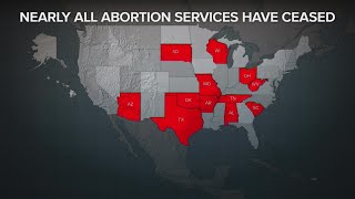 U.S. states make decisions on abortions after Roe v. Wade overturned