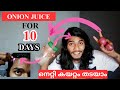 I USED ONION JUICE IN HAIRLINE FOR 10 DAYS HERE IS THE RESULT..! | നെട്ടികയറ്റം തടയാൻ ONION JUICE 💯