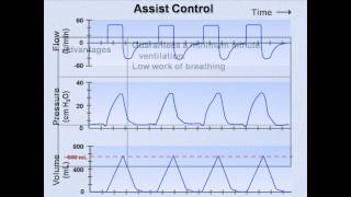 Ventilator Modes (Mechanical Ventilation  Lecture 7)