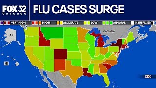 Celebrity Flu cases surging nationwide Wealth