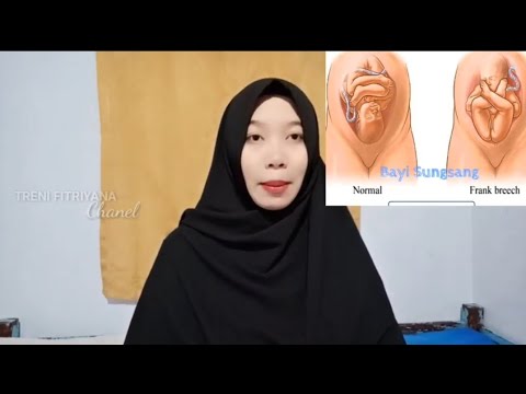 Video: Bidan Ini Telah Menghasilkan Lebih Dari 150 Bayi Sungsang Tanpa C-Sec