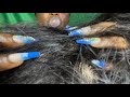 ASMR✨Scalp and hair Massage with Bubblegum Chewing sound.