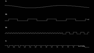 Im Getting Old - (Protracker Family)
Original 4ch Protracker Family composition.
Created with MilkyTracker.
Corrscope renders https://github.com/corrscope/corrscope
Link to Drive Chipmusic folder: https://drive.google.com/drive/folders/16DJXo1ejSVtBGJMzFeJHir7EuvgeOHJ3?usp=sharing Im Getting Old - (Protracker Family)