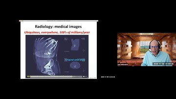 Prof. Leo Joskowicz -  Accelerating Deep Learning Medical Image Processing in Radiology