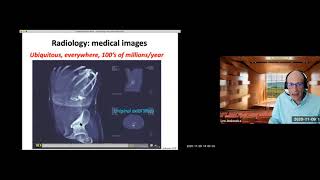 Prof. Leo Joskowicz -  Accelerating Deep Learning Medical Image Processing in Radiology