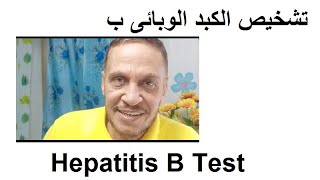 تحاليل الكبد الوبائي ب - Hepatitis B Tests