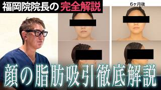【美容初心者必見】脂肪吸引の入り口でもある顔の脂肪吸引をわか…のサムネイル