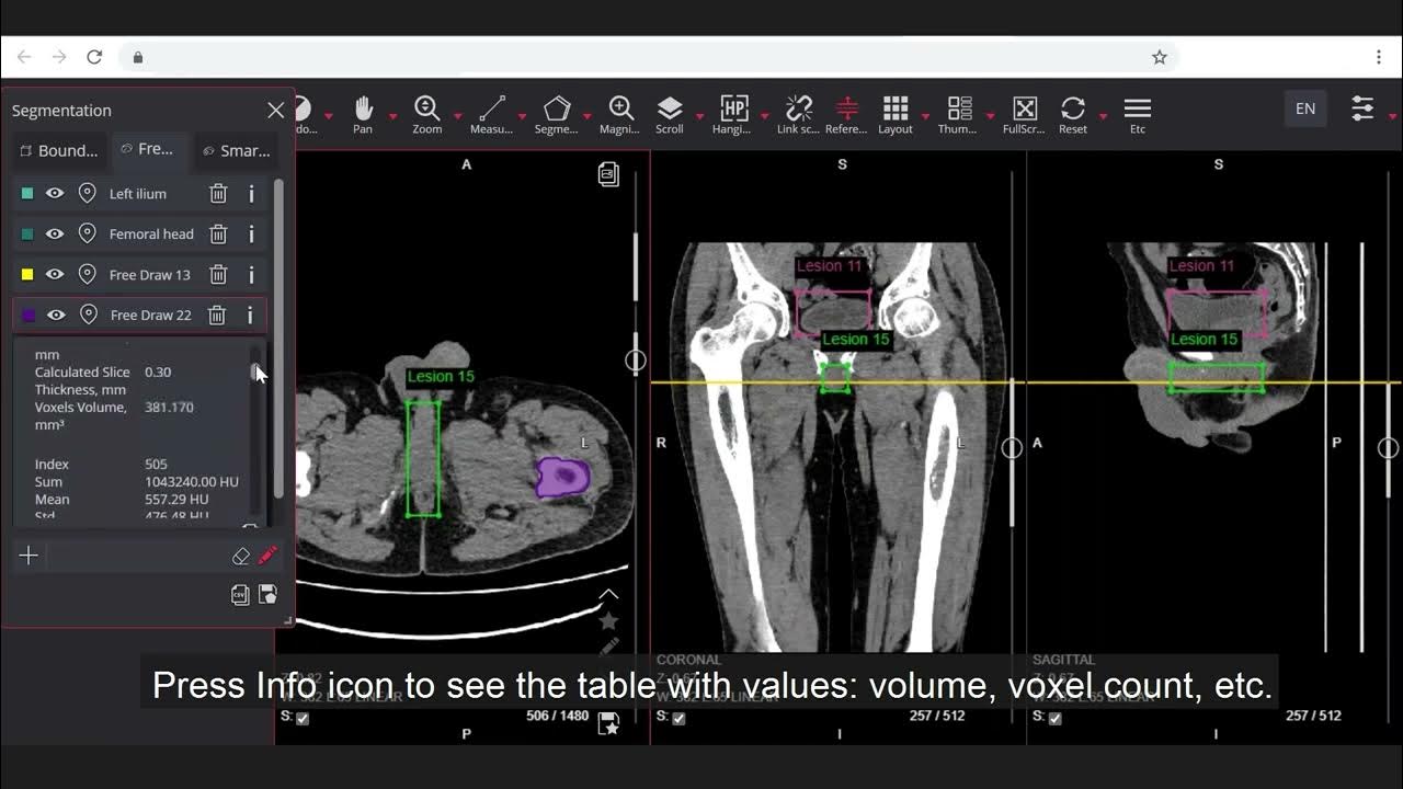 Segmentation tools video presentation Bounding Box, Free Draw, Smart