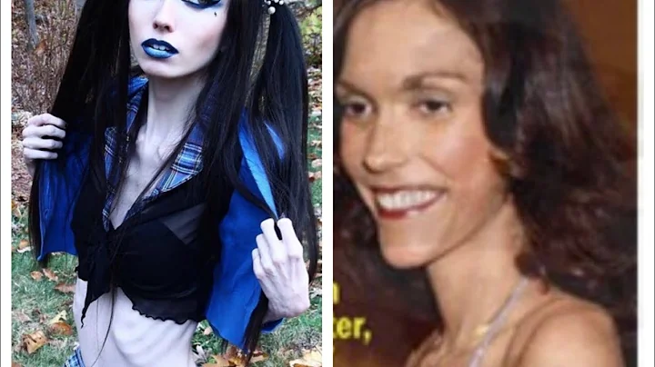 Eugenia Cooney and Karen Carpenter  #eugeniacooney...