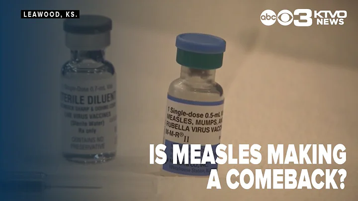 Is measles making a comeback?