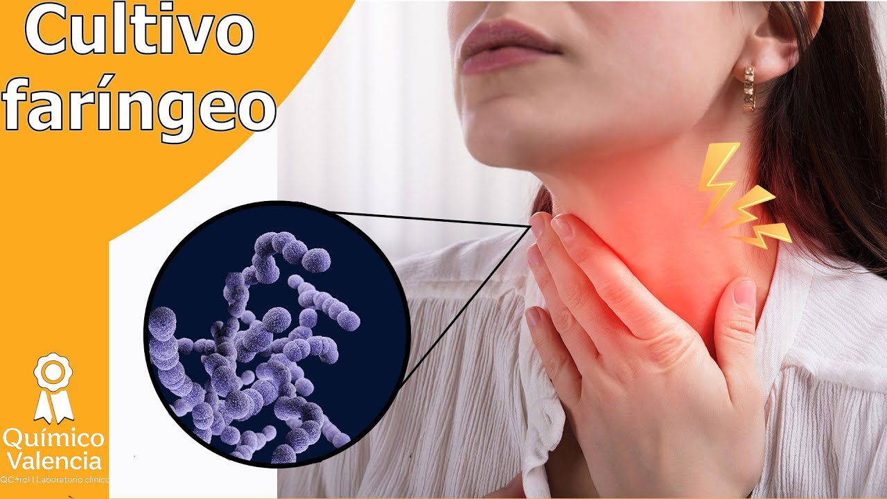 Культура ГЛОТОЧНОГО ЭКСУДАТА: Полное руководство