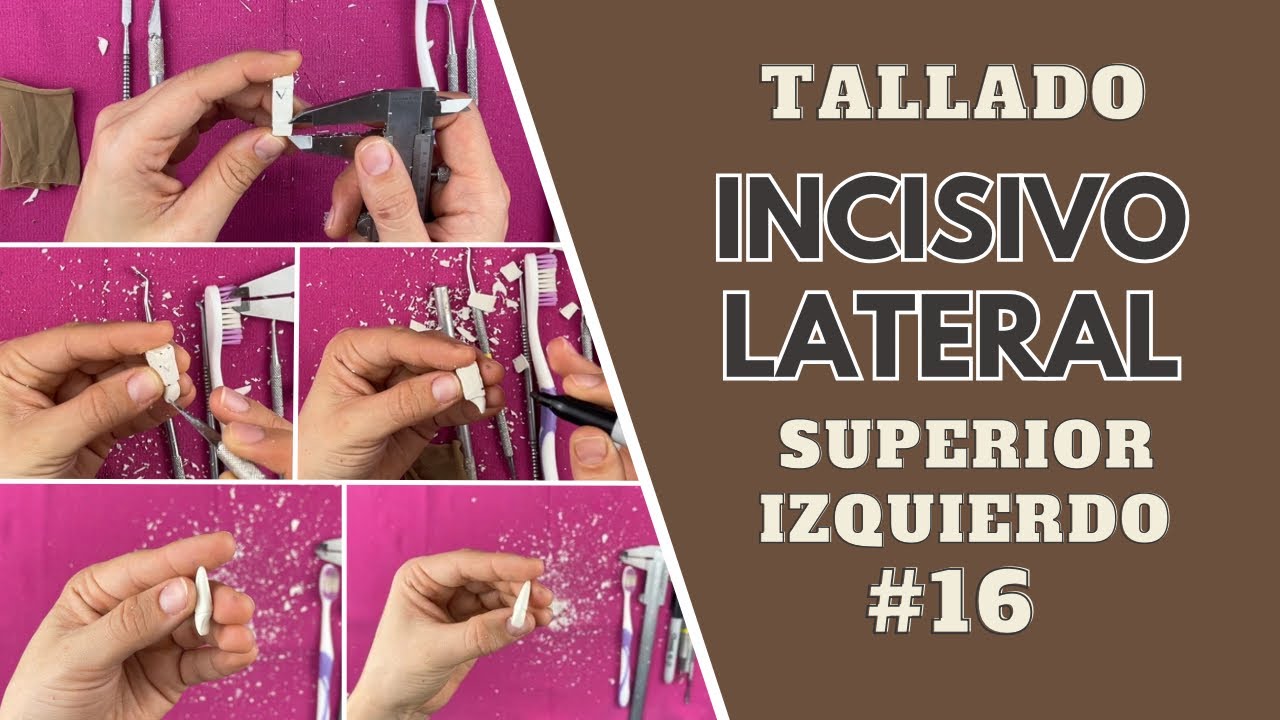 Tallado en cera de incisivo lateral superior izquierdo | Odontologia con Cri