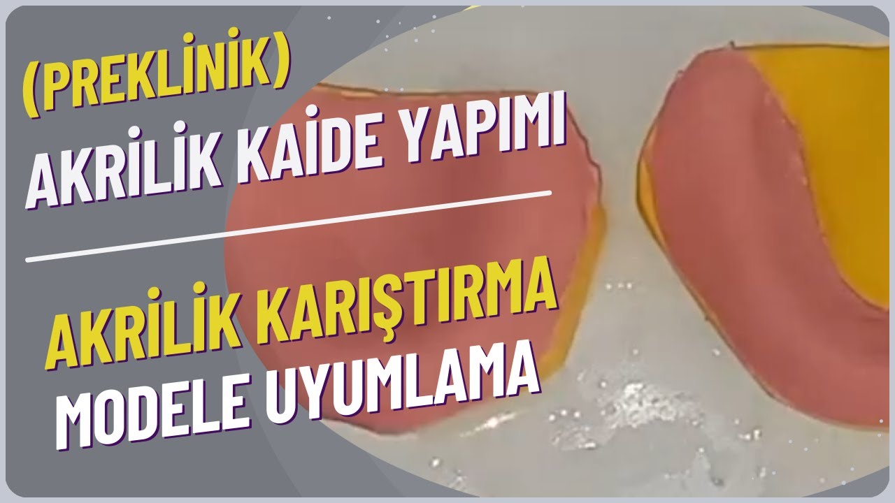 Kaide Plağı Yapımı