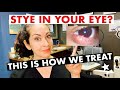 STYES! | What are they and how are they treated? | The Eye Surgeon