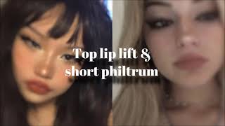 top lip lift surgery subliminal