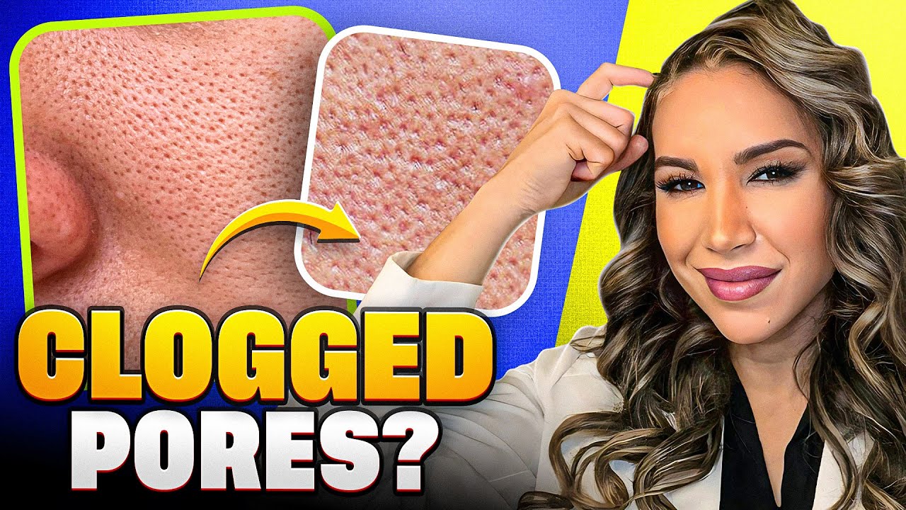 How to Get CLEAR Pores from a Dermatologist!