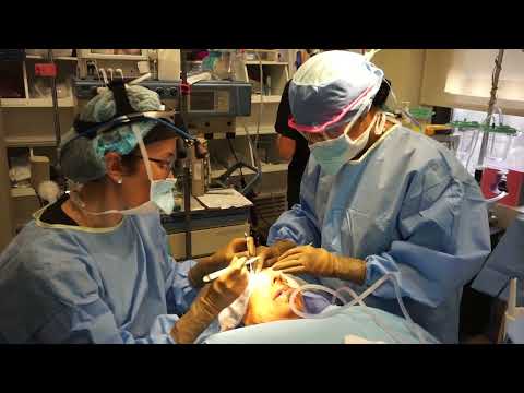 Facelift with upper Blepharoplasty& BrowLift under general anesthesia | Dr. Yael Halaas