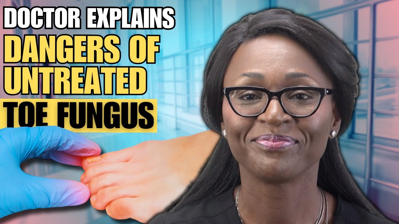 Avoid the Dangers of Toe Fungus ADVICE from a DOCTOR 🩺 🥼 YouTube