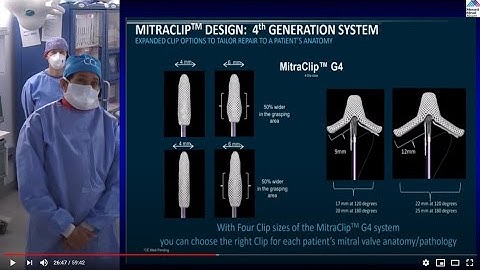 Urgent Appropriately Indicated MitraClip Procedure in Patient with Cardiogenic Shock in Covid-19 Era