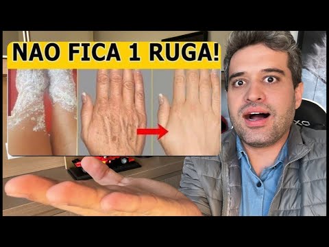 ÓLEO MÁGICO ACABA COM RUGAS E MANCHAS DAS MÃOS EM 8 DIAS - DR RENATO SILVEIRA