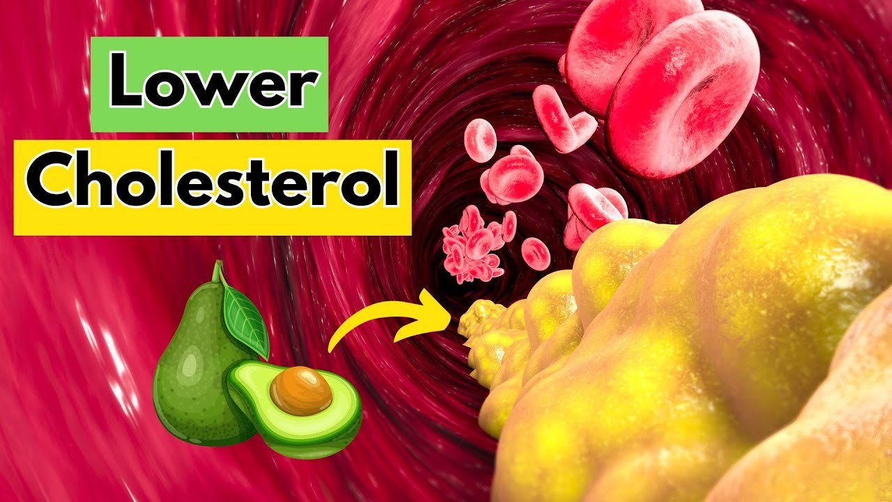 10 Foods to Lower LDL Cholesterol Levels YouTube
