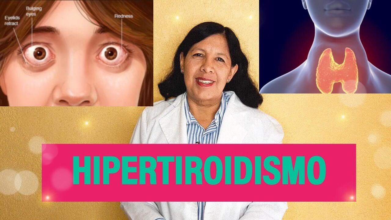 Que es el HIPERTIROIDISMO, SINTOMAS y TRATAMIENTO Mi Dra Youtuber YouTube