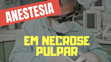 O que é um dente necrosado?
